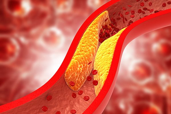 Reduce Cholesterol