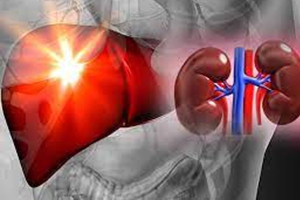 Kidney / Liver / Heart Issues